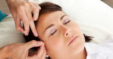 Slaap Acupunctuur